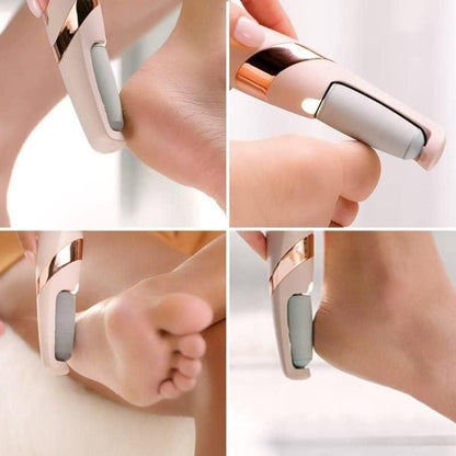 Electronic Cordless Pedicure Callus Dead Skin Remover Polishing Tool.